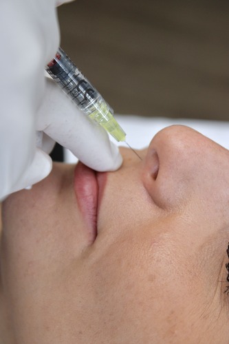 injection rhinoplastie