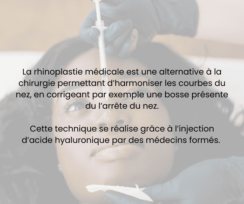 Rhinoplastie médicale à Marseille et à Nice
