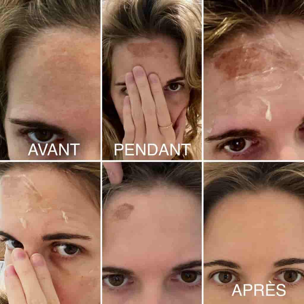 evolution-seance-de-peeling.jpg