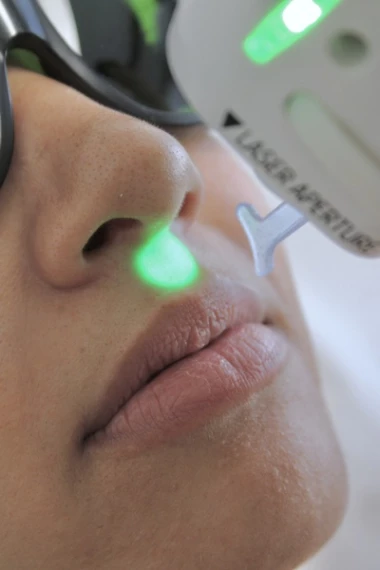 Épilation laser du visage | La Clinique Laser Marseille et Nice
