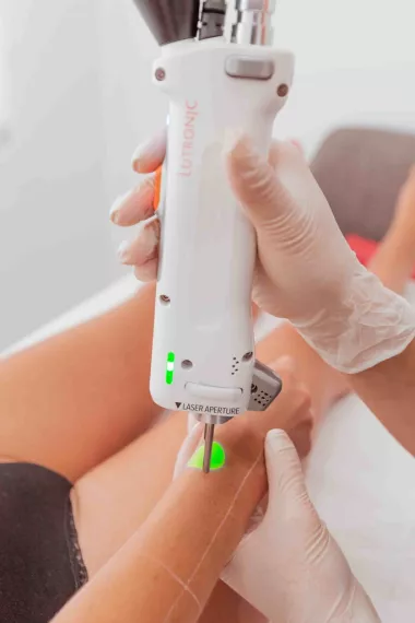 À partir de quel âge peut-on débuter l'épilation au laser ?