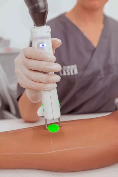 Choisir L' épilation au laser ou lumière pulsée ?