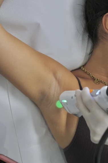 Épilation laser en janvier à Nice et Marseille | Anticipez l’été