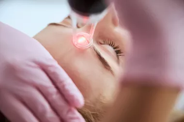 Laser et bronzage : tout savoir sur l'épilation et l'exposition au soleil