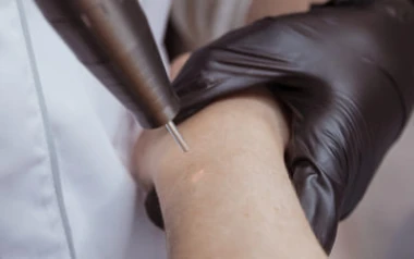Épilation Laser : Pourquoi Commencer à la Rentrée | La Clinique Laser