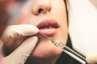 L'injection pour repulper vos lèvres - Clinique Nice