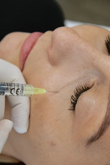 Hyperpigmentation péri-orbitaire | Traitement à La Clinique Laser