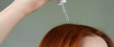 Stoppez la chute de cheveux avec le traitement PRP capilaire