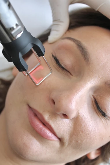 Suites et cicatrisation après une séance de laser CO2 fractionné