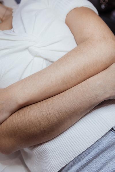 Décoloration des poils sur les bras à La Clinique Laser