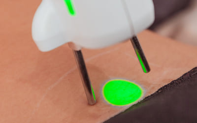 epilation laser maillot