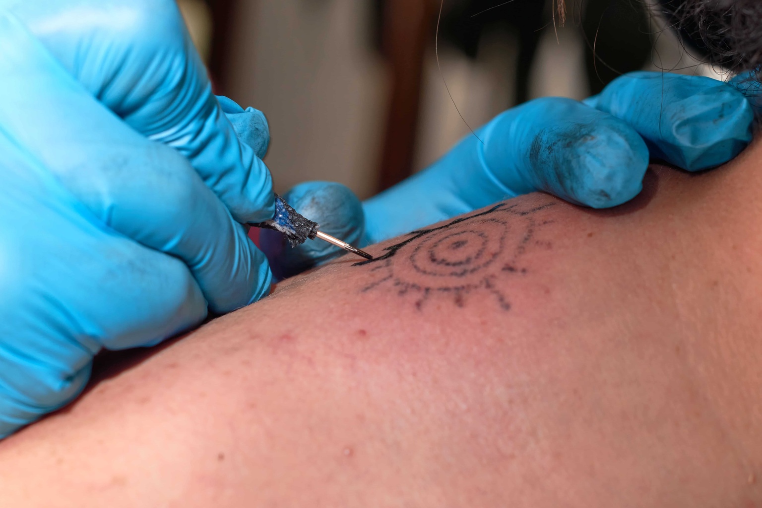 Eliminer tatouage couleurs