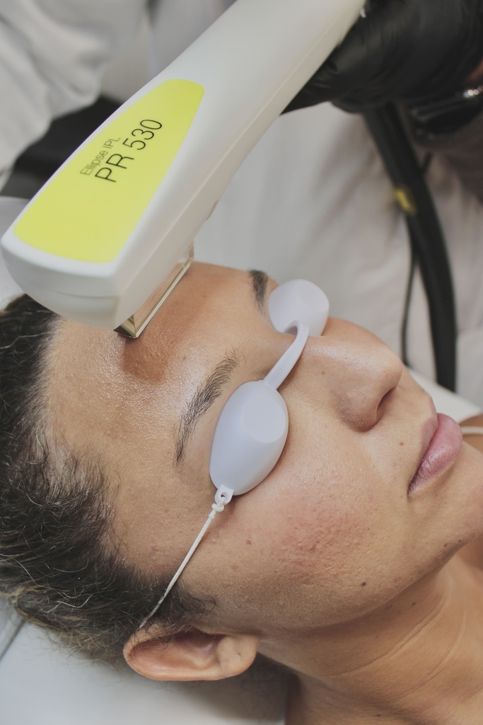 IPL Nordlys La Clinique Laser