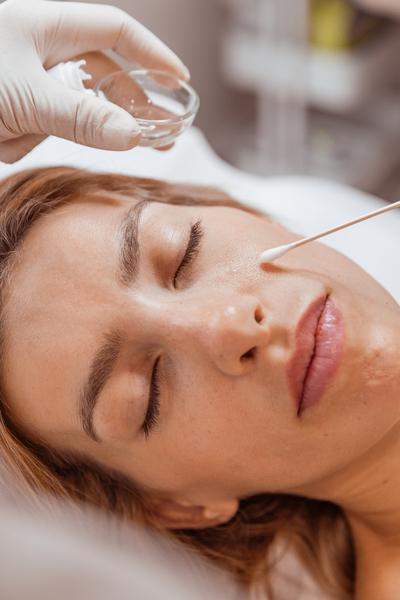 peeling blemiderm visage